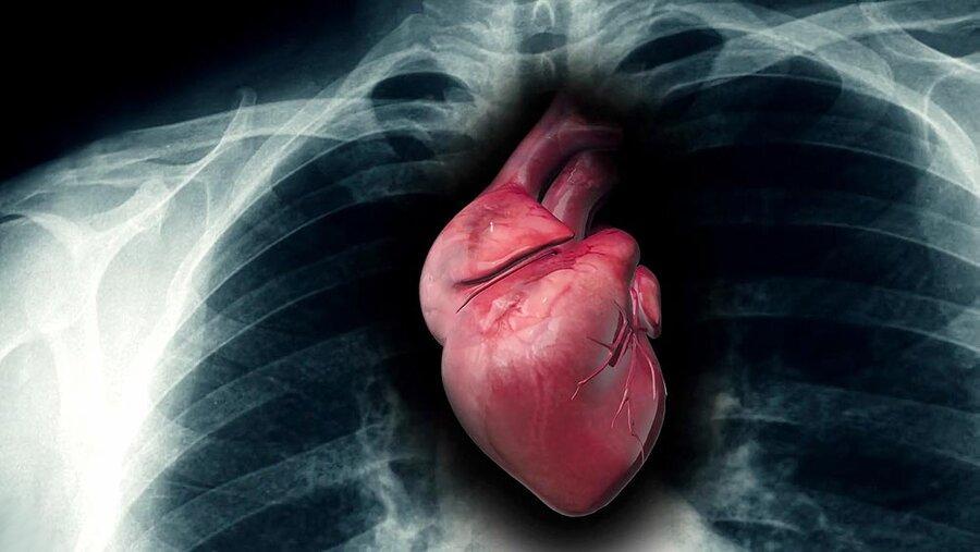 پنج نشانه نادیده گرفته شده مشکل قلبی
