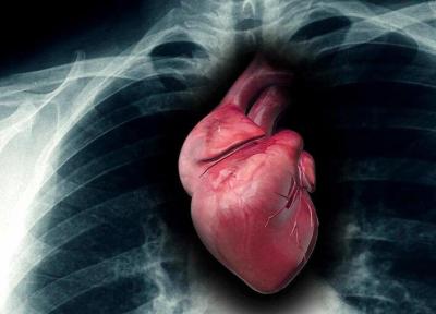 پنج نشانه نادیده گرفته شده مشکل قلبی